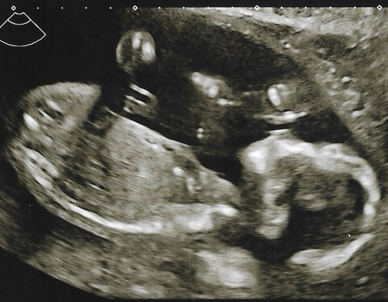Due January 2026 - thread 2
