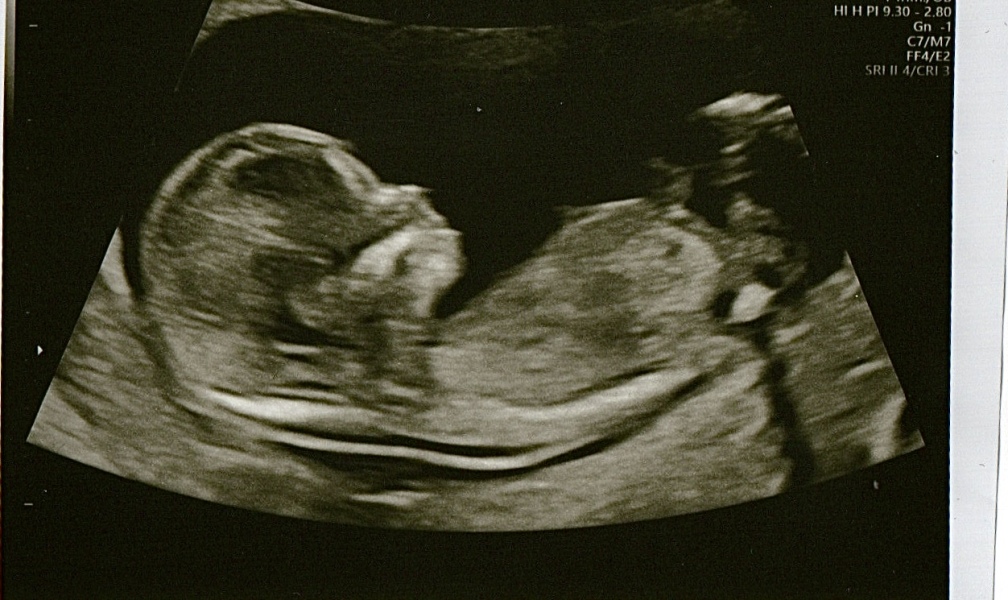 Gender prediction (just for fun!)
