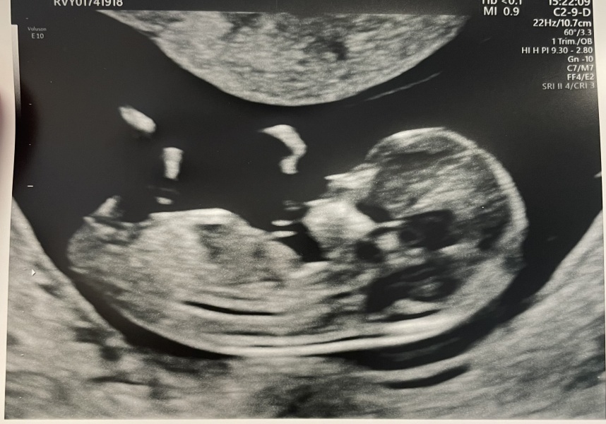 Gender guesses please