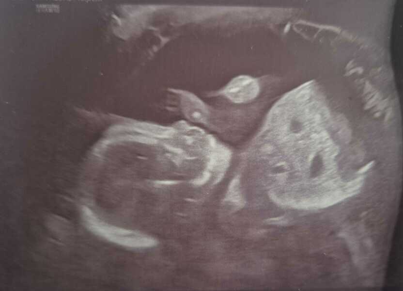 Due January 2026 - thread 2