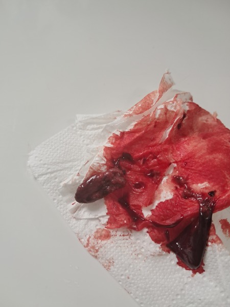 Warning - what is this?