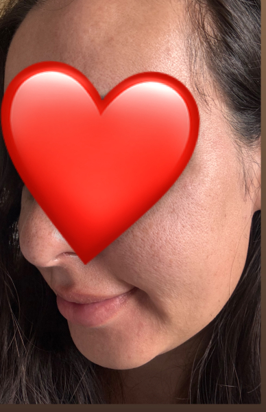 Skin texture - why is it like this?