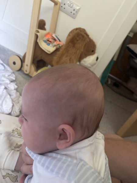 Indent in 4 month olds head? Flat head?