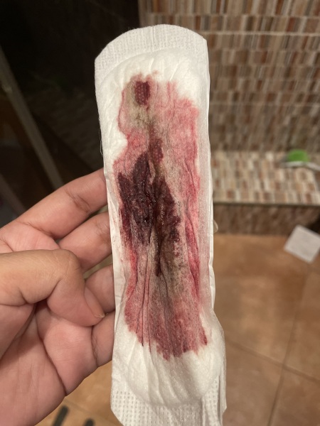 9 weeks but bleeding