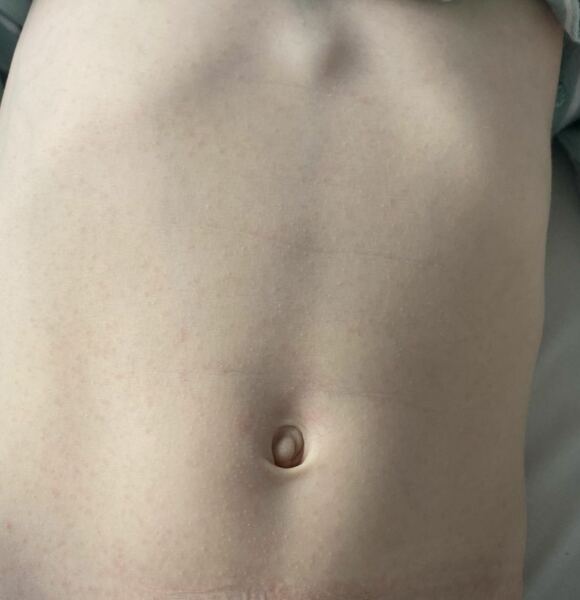 What are these spots?