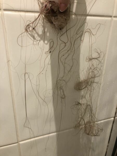 Is it normal to shed this much hair in the shower? (Warning: GROSS pic)