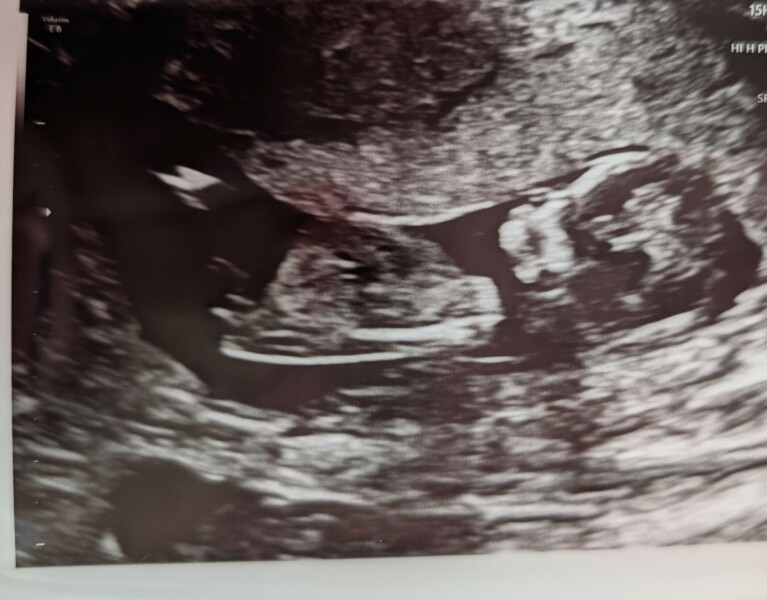 Boy or girl!?