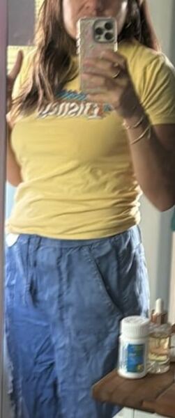 Would wear a skirt with these scratches?
