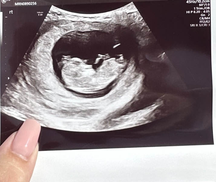 Boy or girl?