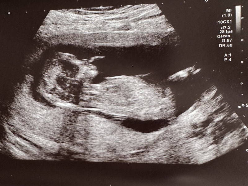 Boy or girl?