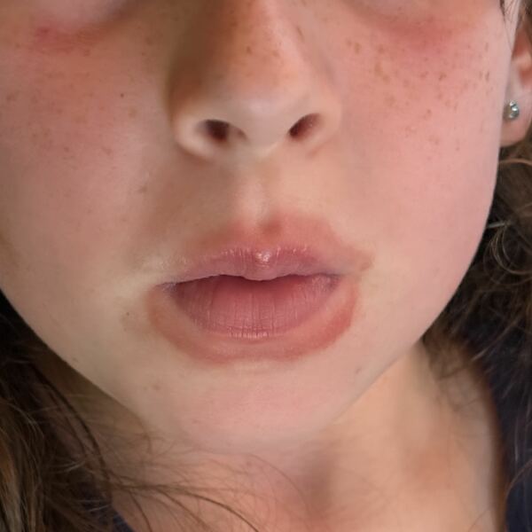 Daughter’s lips - picture in thread