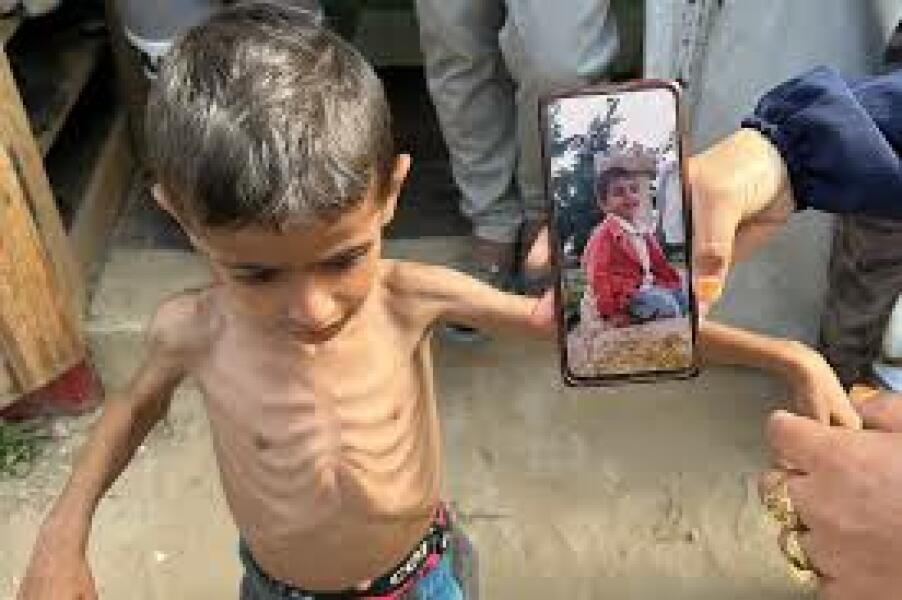 300 children from Gaza to be brought to the UK for free specialist NHS care