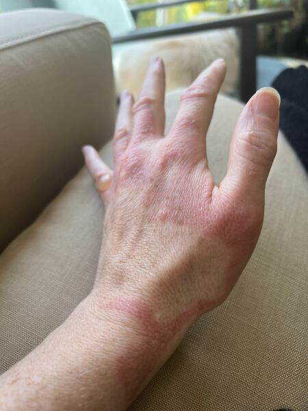 Would you go to minor injuries?