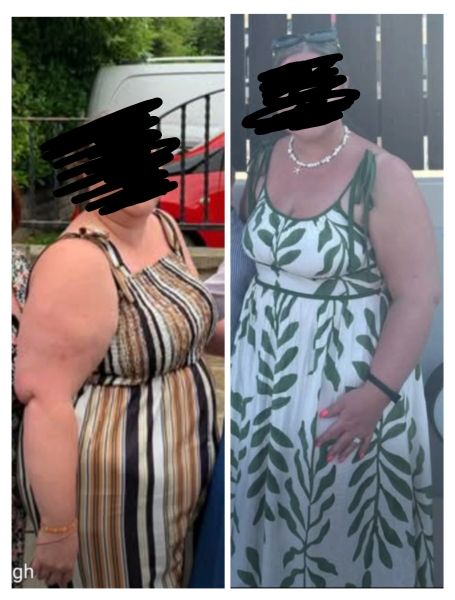 Anyone want to share their before and after pics?