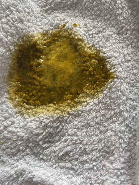Baby’s poo