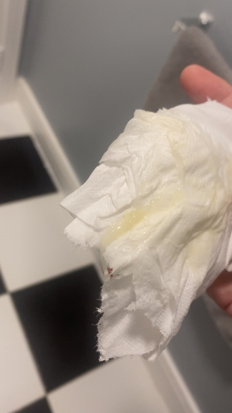 Mucus plug 32 weeks pregant