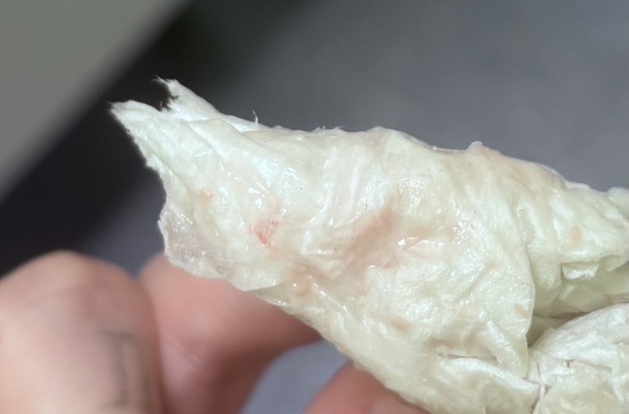 Implantation Bleeding? TMI PHOTO