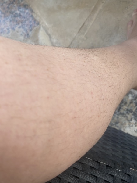 Would you go to the beach with legs this hairy?