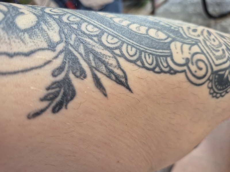 Would you go to the beach with legs this hairy?