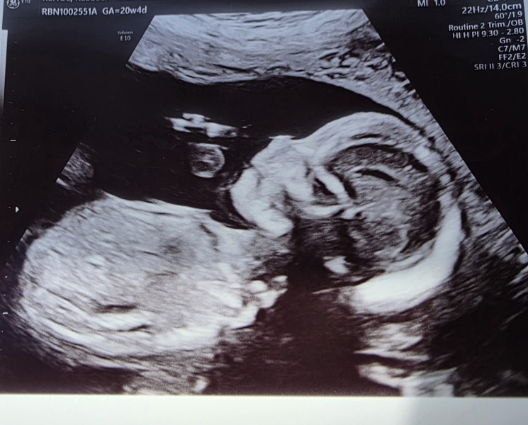Due December 2025
