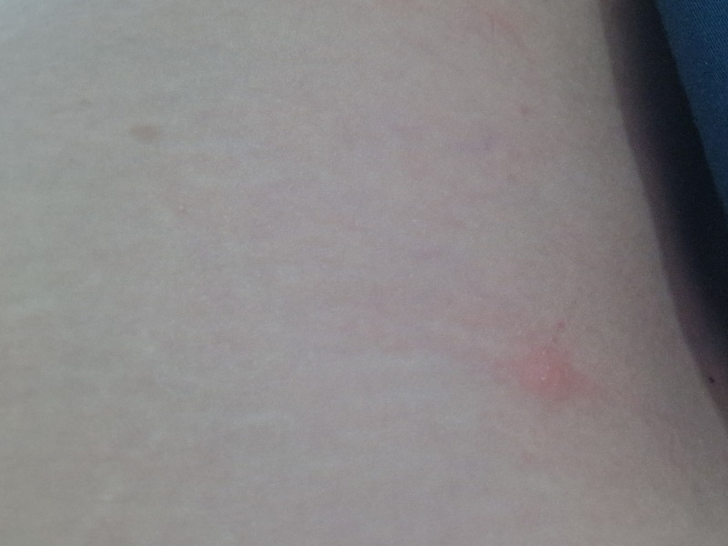 Are these bedbugs?