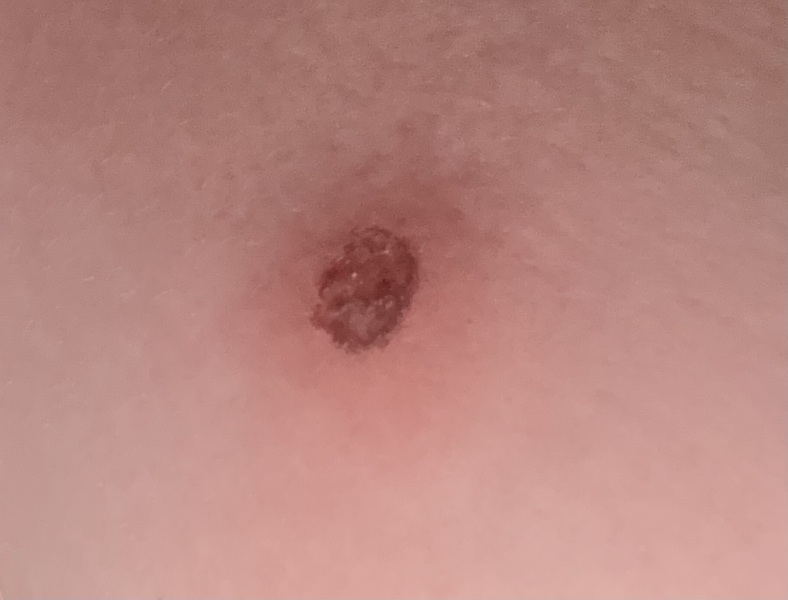 Advice please