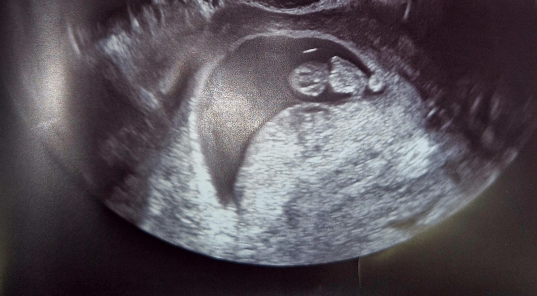 Due March 2026 🤍 pt 2