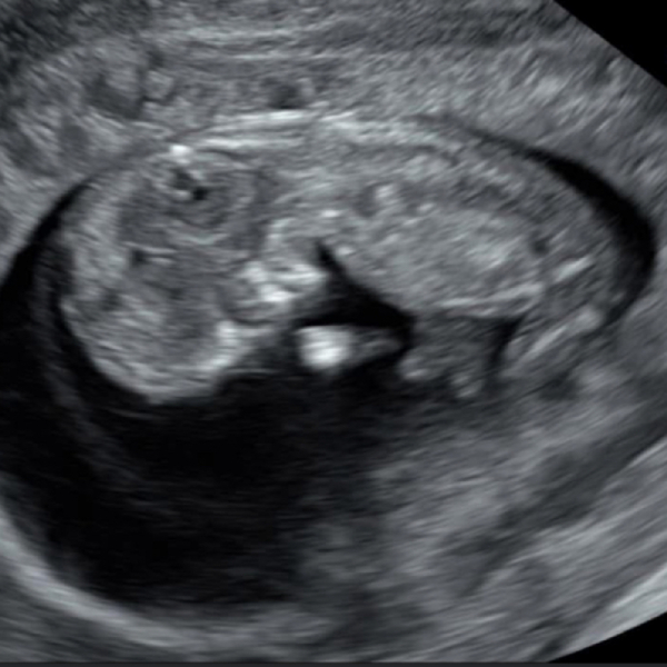 Skull Theory - Gender Prediction - Bit of fun!