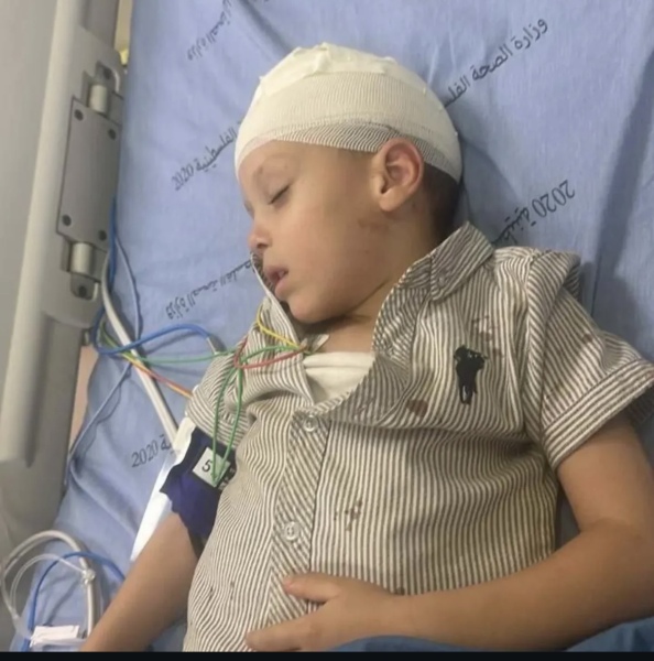 5 year old Jude Shalabi sustained a skull fracture after settlers threw stones at him near Shomrom settlement in the occupied West Bank