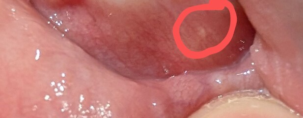 Dental issues in 11 year old