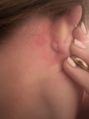 Freaking out… Can anyone tell me what this lump is behind my ear!?