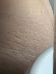 Lovely boyfriend doesn’t know how bad my stretch marks are yet.