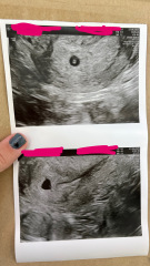 Concerned and upset with my first ultrasound?