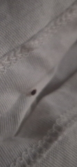 Are these bedbugs?