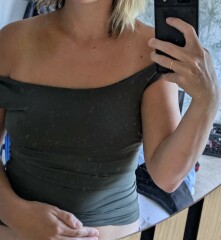 Clavicle break chances of op?