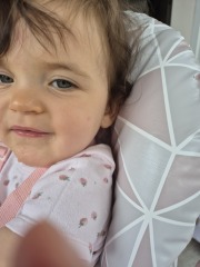 Red blotches when eating