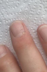 It looks like tree sap is coming out of my finger.