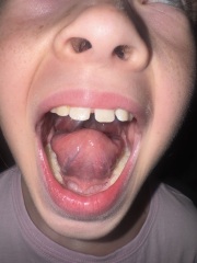 Daughters tongue
