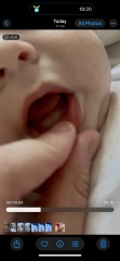 TEETHING? Are they about to pop?