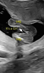 Does this look like boy or girl?💙💗😊