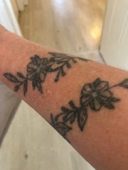 Help! Can anything be done to salvage these tattoos?? PICS attached.