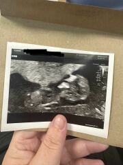 Nub at 11w4d