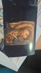 BOY or GIRL