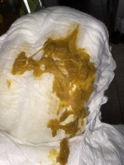 Cmpa nappy ?? (Warning picture)