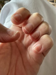 Terrible nails after builder gel removal