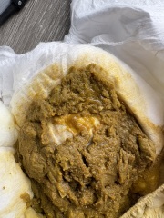 Cmpa nappy ?? (Warning picture)