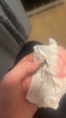 Is this implantation bleeding