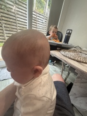 Four-month-old’s head