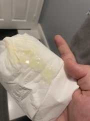 Mucus plug 32 weeks pregant