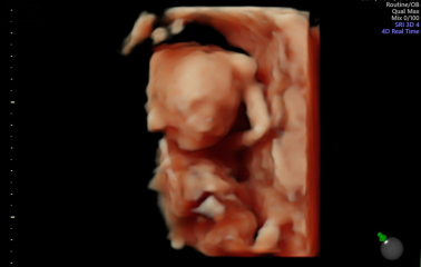 3d scan at 17 weeks 🥹🤍